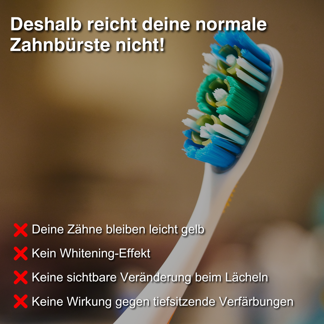 GermanSmile Whitening Kit - Garantiert weiße Zähne