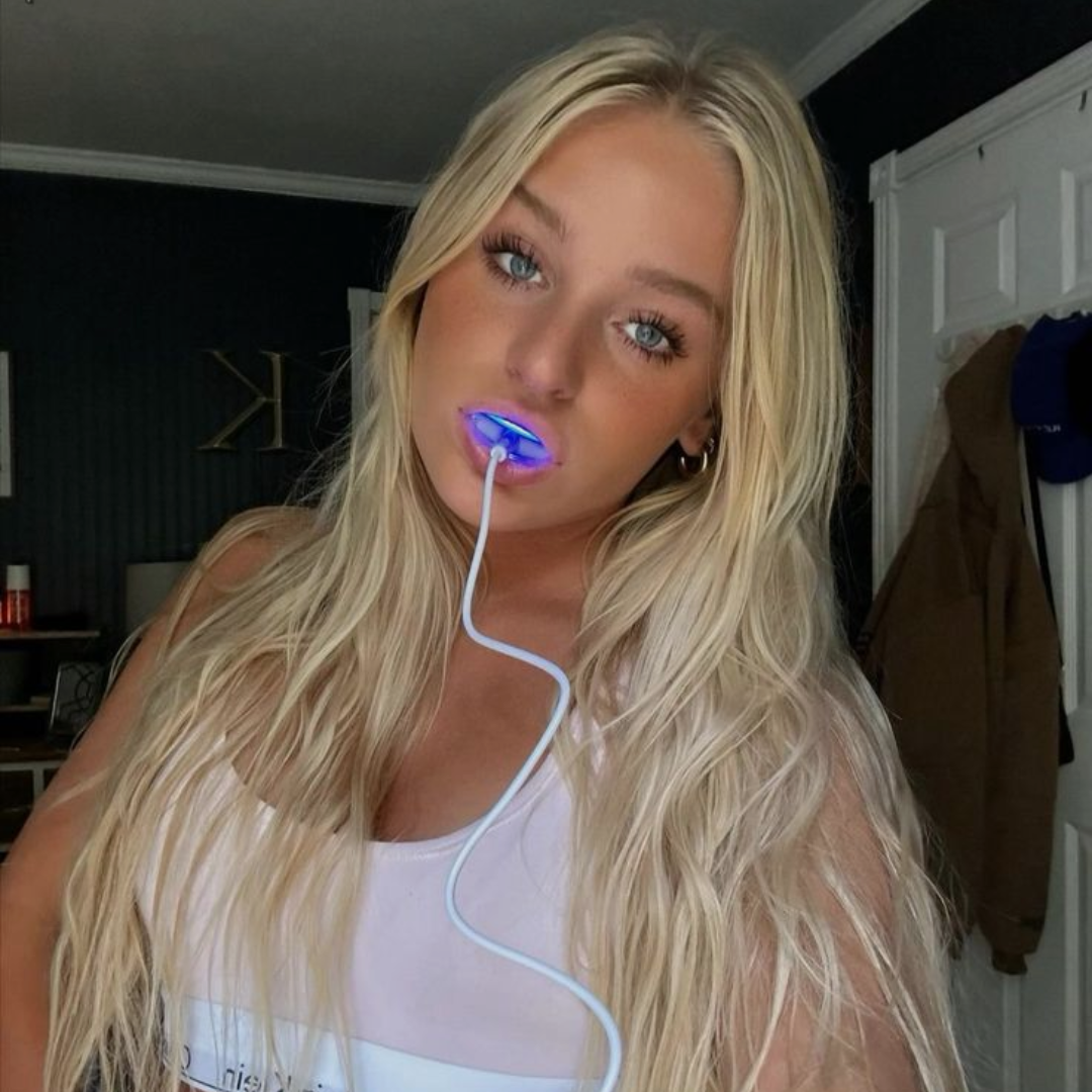 files/Beforewhitening_rinseyourmouthorgentlybrushteeth._5.png