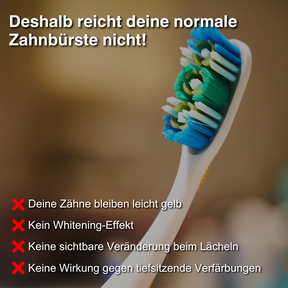 GermanSmile Whitening Kit - Garantiert weiße Zähne